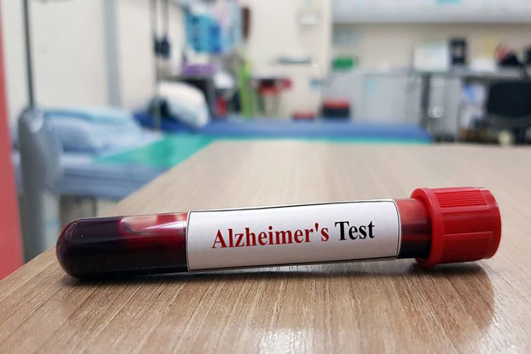 aspects of Alzheimer disease Living Maples