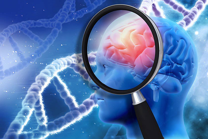 Alzheimer's disease and genes