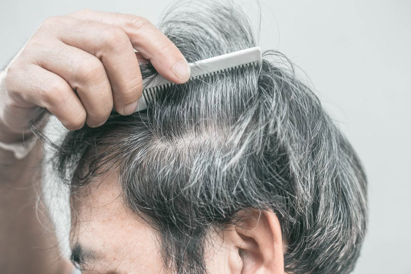 Easy Ways to Cover Your Gray Hair Roots | Living Maples