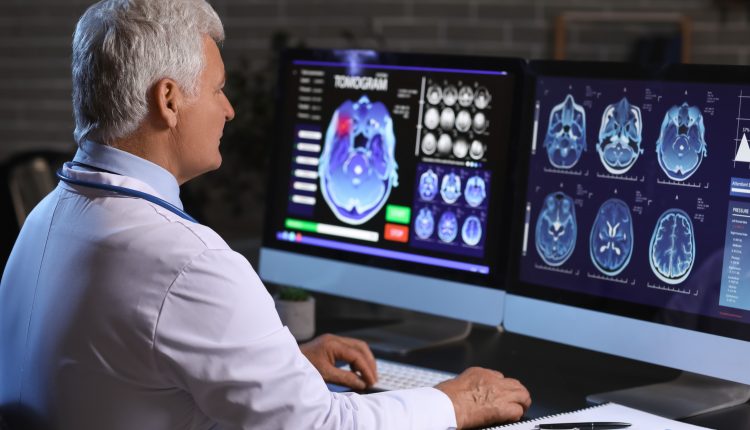 A specialist looking at scans of a dementia patient's brain