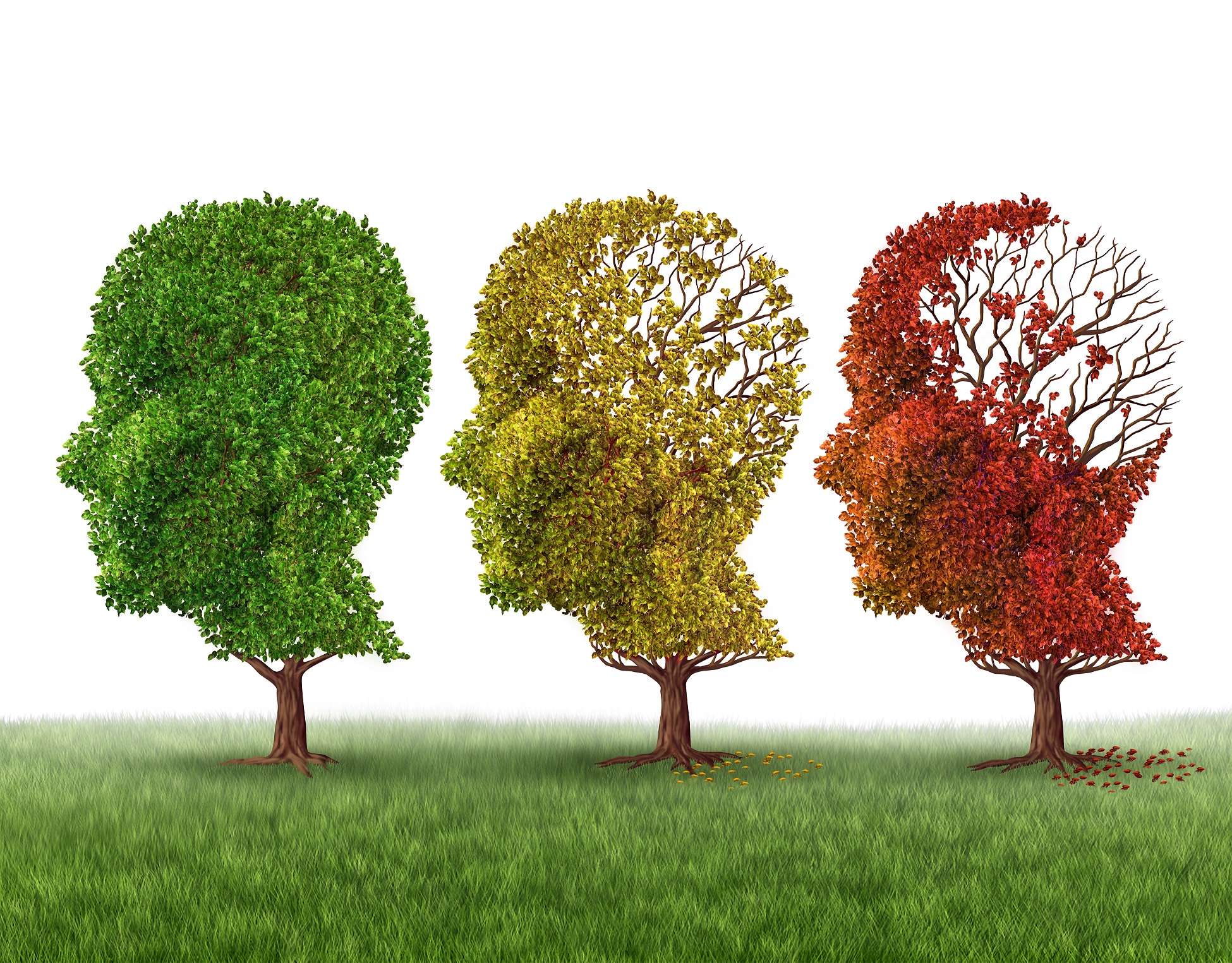 Alzheimer's and the brain illustration